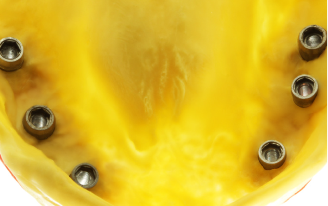 PERFIT Monophase