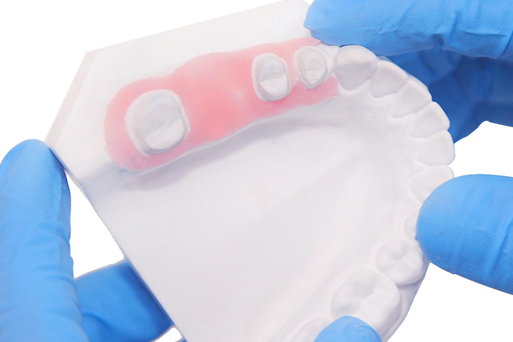 A-Silikon für Zahnfleischmaske