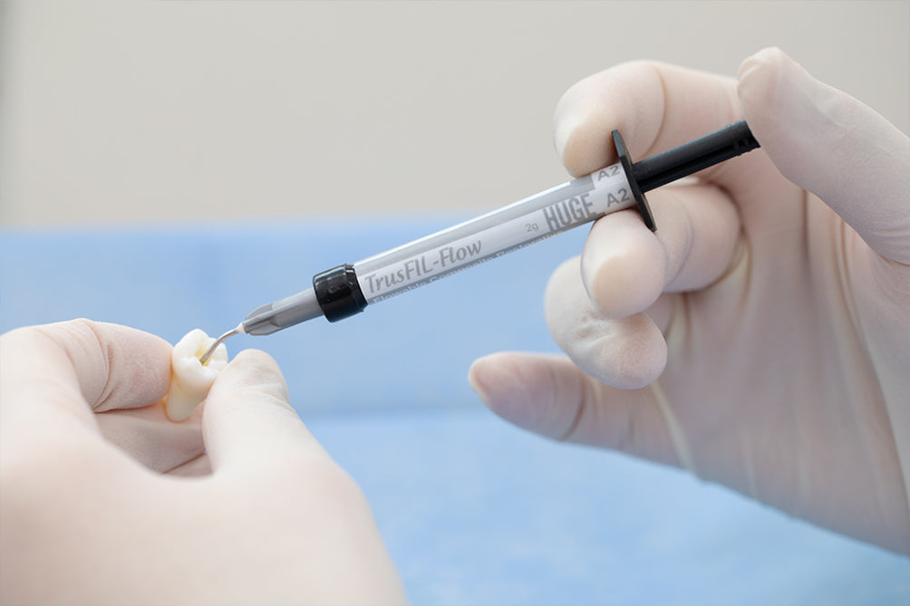 Dental Composite Restorative — HUGE Dental