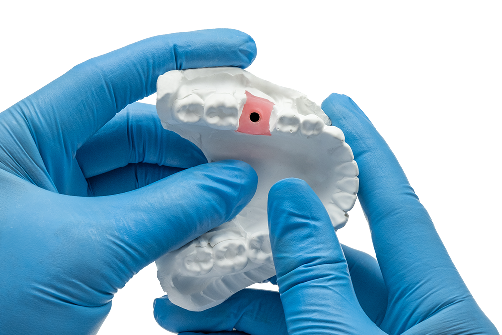 A-Silikon für Zahnfleischmaske